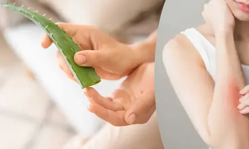 Natural and Easy Home Remedies to Soothe Rashes and Itchy Skin