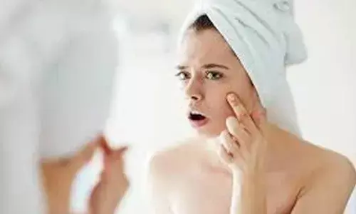 Effective Natural Home Remedies to Fade Dark Spots Naturally