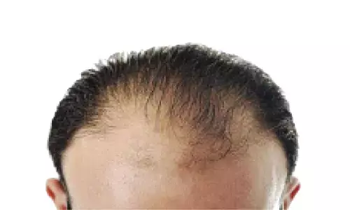 Hair-raising: Hundreds fall prey to bald cure con in city