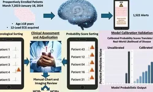 AI algorithm can help identify high-risk heart patients: Study