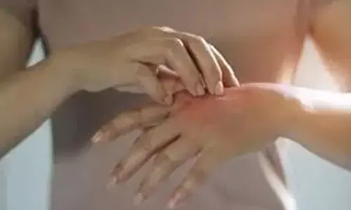 Surge in hand, foot, mouth disease cases forces closure of schools in Malaysias Sabah state