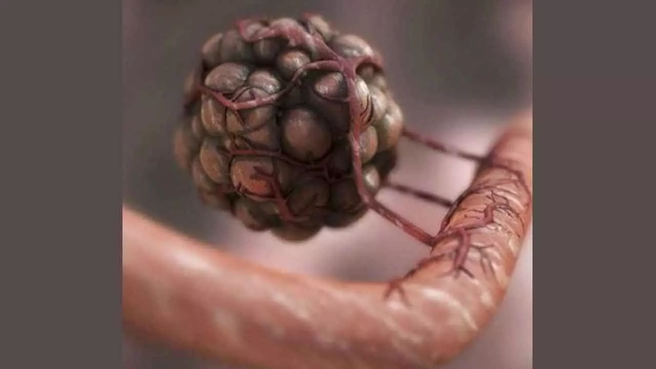 Researchers find genetic fingerprints to predict efficacy of immunotherapy Researchers find genetic fingerprints to predict efficacy of immunotherapy