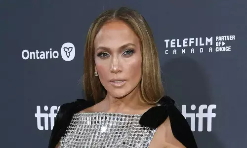 Jennifer Lopez sustains facial wound during American Music Awards rehearsals