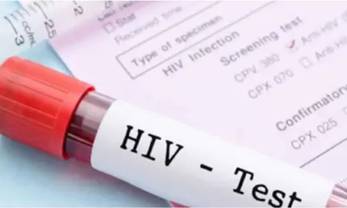 Singapore reports 151 new HIV cases in 2024, over half diagnosed at late stage