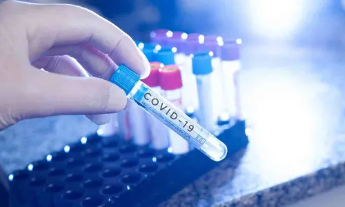 Govt directs authorities to stock up Covid-19 testing kits