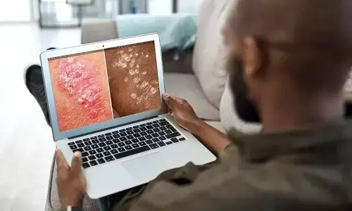 Psoriasis patients may require more than skin treatment, finds study