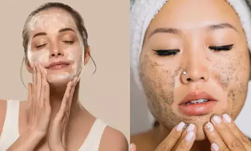 Essential Summer Skincare Hacks to Combat Oily Skin