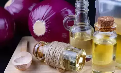 Onion Hair Oil Remedy to Naturally Reduce Hair Fall