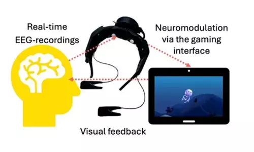Researchers develop brain training game for chronic nerve pain