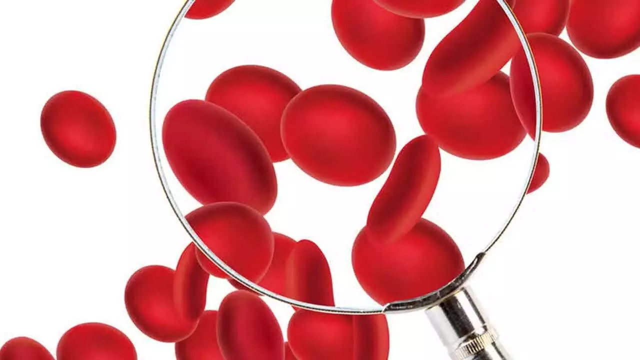 Scientists find gene mutation that links iron deficiency with Crohn’s disease Scientists find gene mutation that links iron deficiency with Crohn’s disease