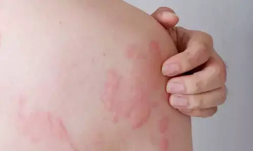 Proven Natural Remedies to Soothe Itchy Skin Rashes