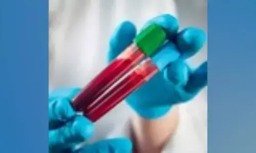 Amazon Diagnostics: Book Lab Tests at Home with Fast Results in 6 Cities