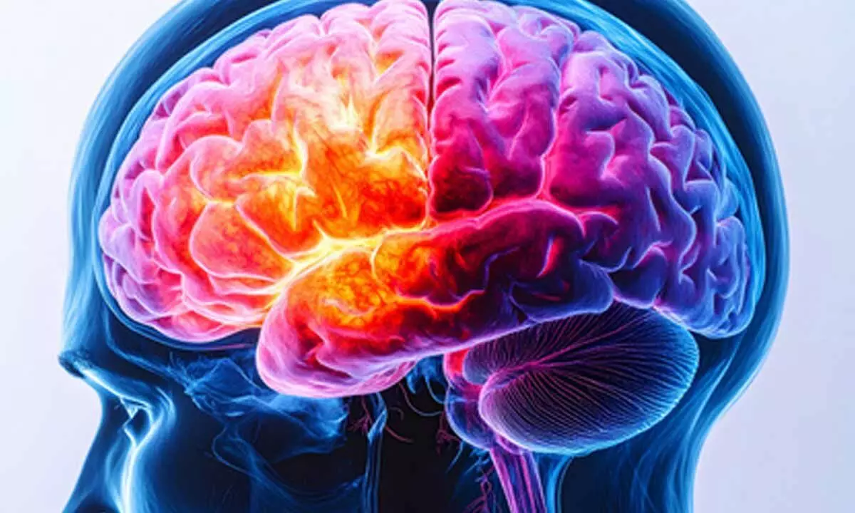 Study finds genetic link for rare childhood brain developmental disorder Study finds genetic link for rare childhood brain developmental disorder