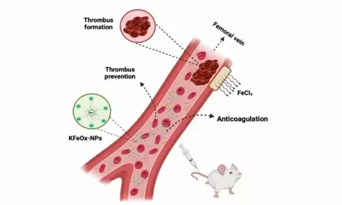 IIT-BHU bioengineers develop nanoparticles to stop blood clotting