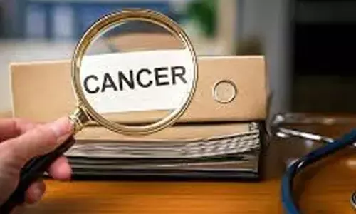 New AI tool to revolutionise personalised cancer treatment