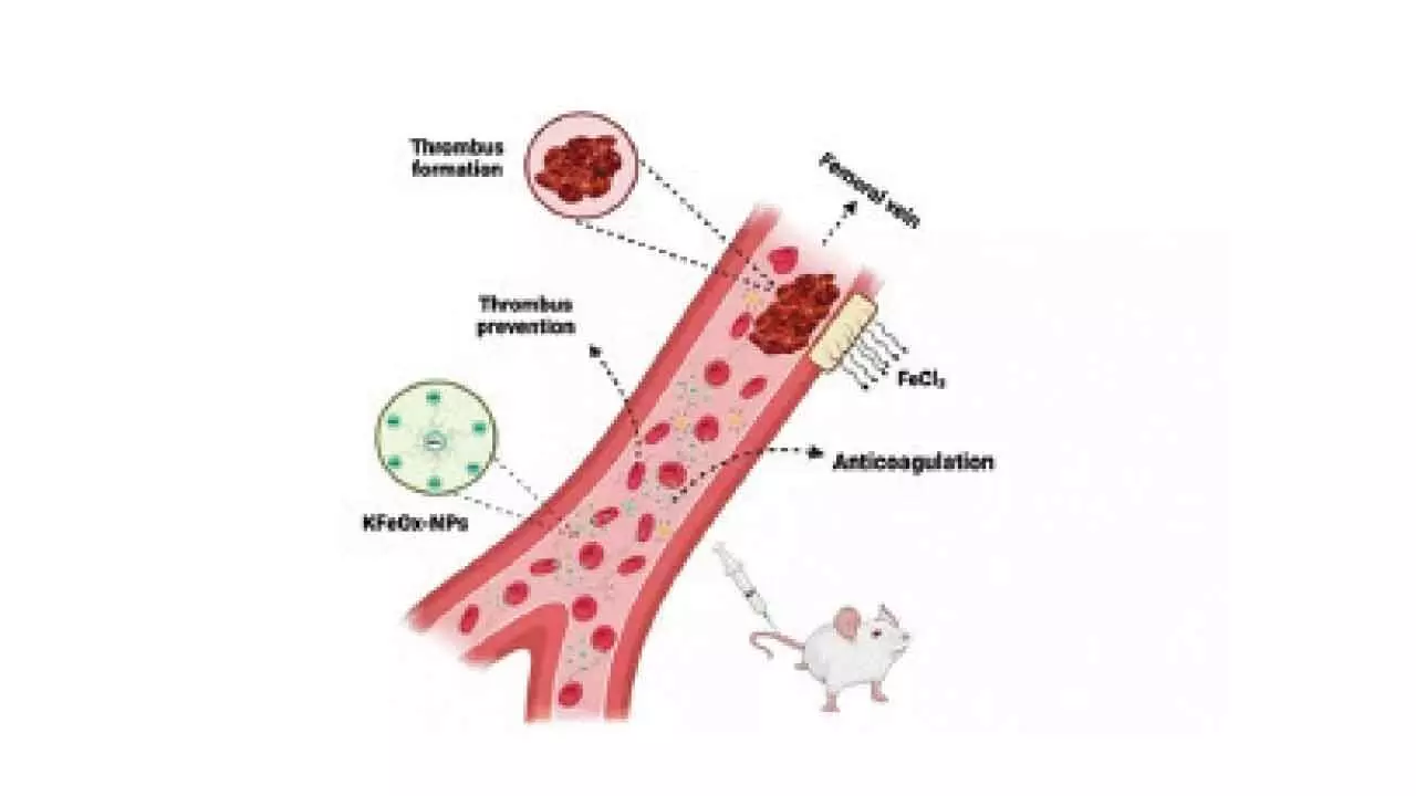 IIT-BHU bioengineers develop nanoparticles to stop blood clotting IIT-BHU bioengineers develop nanoparticles to stop blood clotting