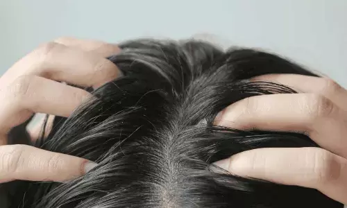 Quick Hacks to Fix Oily Hair Without Washing