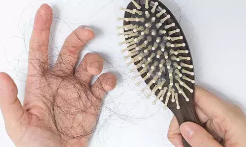Why Hair Fall Worsens During Monsoon and How to Tackle It
