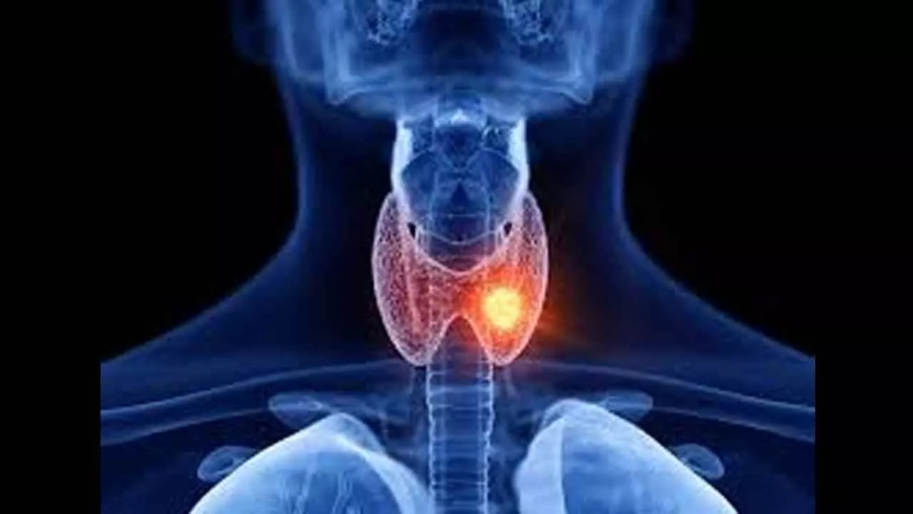 Minimally invasive procedure cures rare thyroid disorder without scars Minimally invasive procedure cures rare thyroid disorder without scars