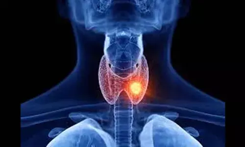 Minimally invasive procedure cures rare thyroid disorder without scars