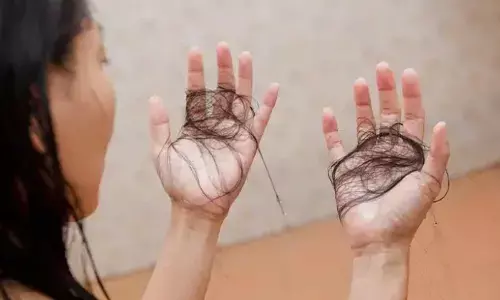 Effective Home Remedies to Control Monsoon Hair Fall Naturally