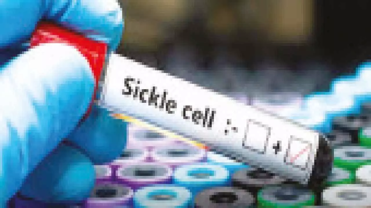 Six crore screened for sickle cell disease: Health Ministry