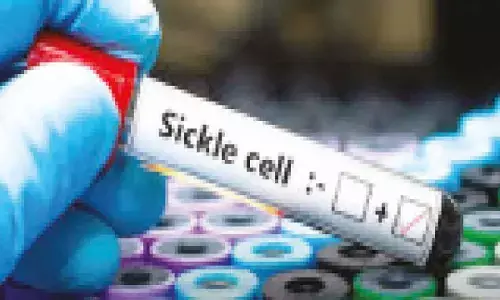 Six crore screened for sickle cell disease: Health Ministry