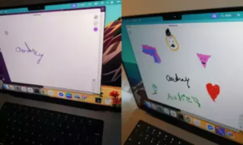 Paralysed Woman Writes Her Name After 20 Years Using Neuralink Brain Implant