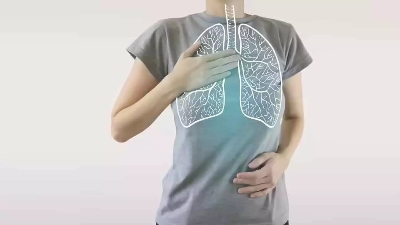 25% lung cancer cases are of non-smokers 25% lung cancer cases are of non-smokers