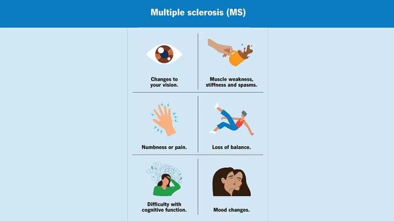 Multiple sclerosis may emerge a decade before neurological symptoms begin to appear Multiple sclerosis may emerge a decade before neurological symptoms begin to appear