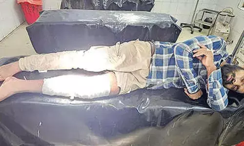 Notorious criminal Nahak injured in encounter