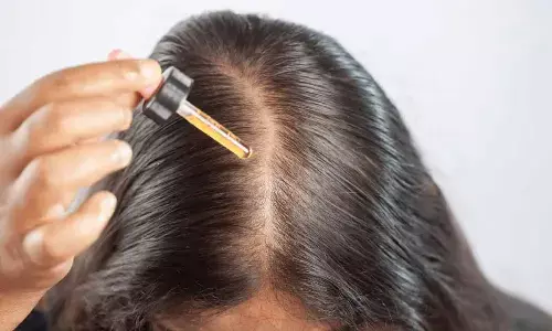 Skipping Hair Oil? Here’s What Happens to Your Hair Over Time