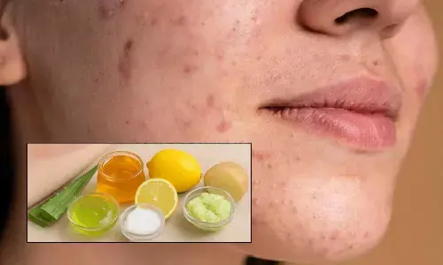Natural Home Remedies to Gently Fade Face Scars
