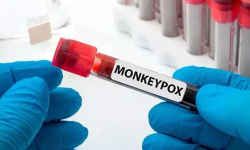 Mpox deaths surpass 1,900 in Africa since 2024: Africa CDC