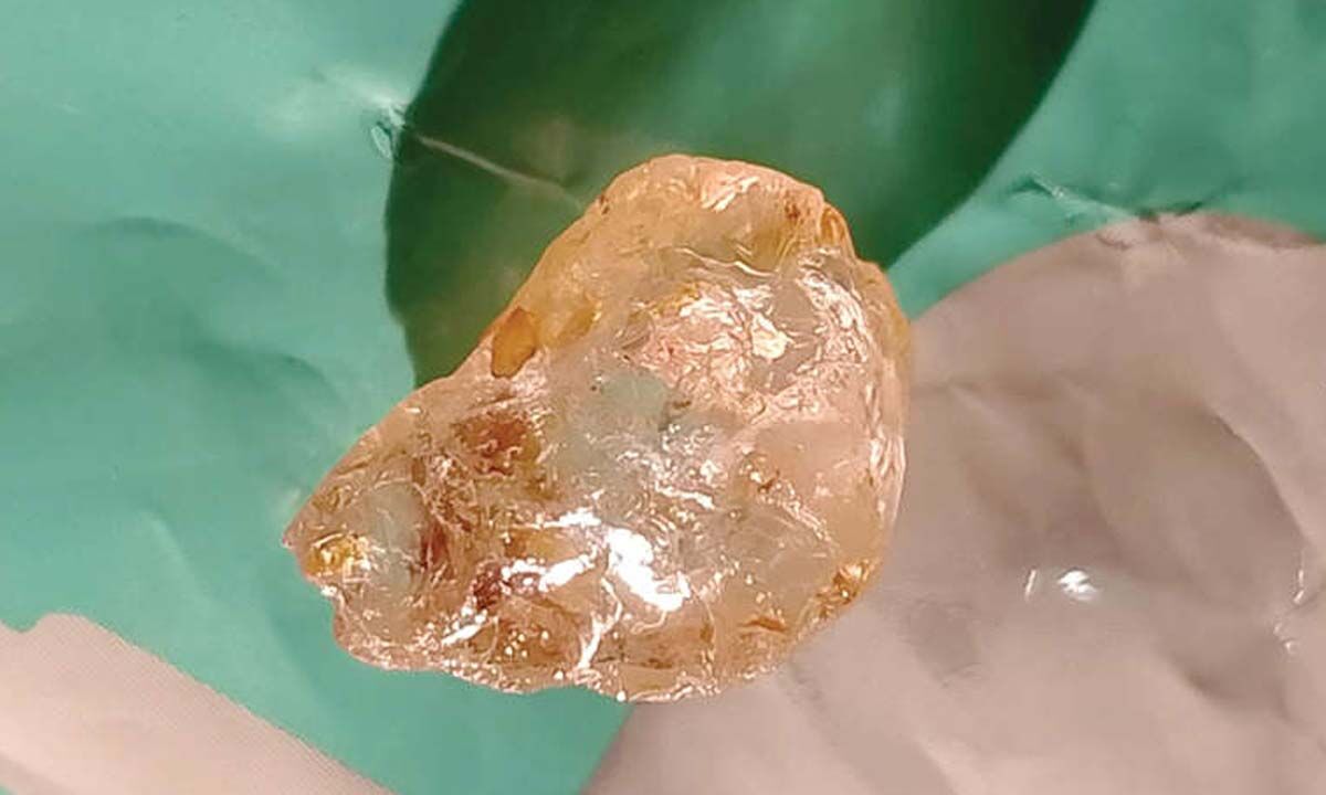 52-Carat Diamond Discovered in Paritala Area, India