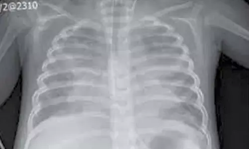 Three-yr-old overcomes extremely rare critical complications