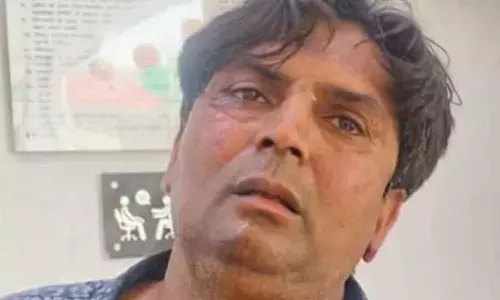 Delhi CM assault: BJP claims attacker linked with AAP, shares his photo with party MLA