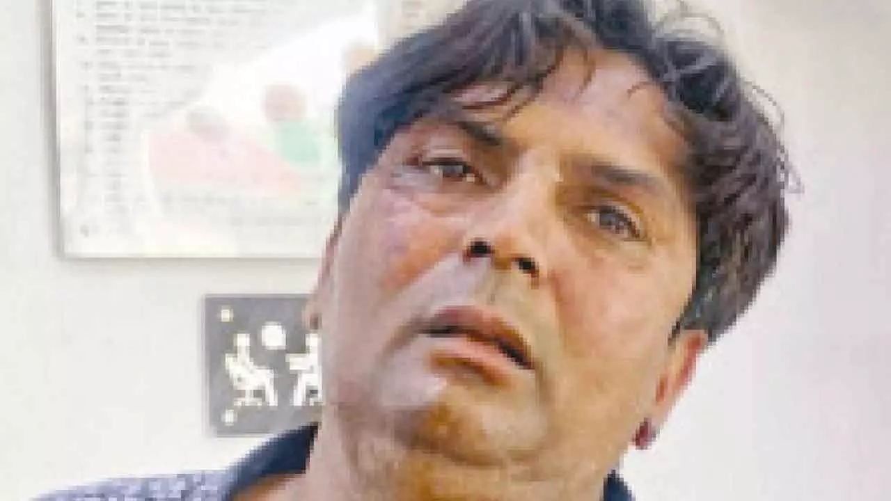 Gujarati Man held for attacking Delhi CM: My son loves dogs, he was upset after SC order says Mother Gujarati Man held for attacking Delhi CM: My son loves dogs, he was upset after SC order says Mother