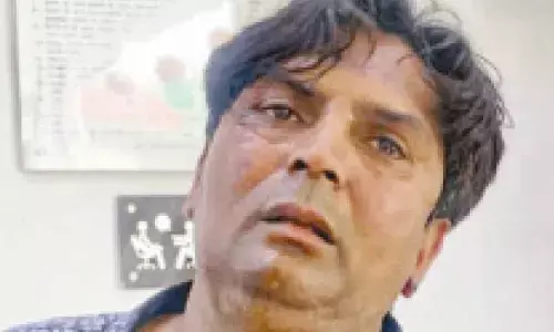 Gujarati Man held for attacking Delhi CM: My son loves dogs, he was upset after SC order says Mother