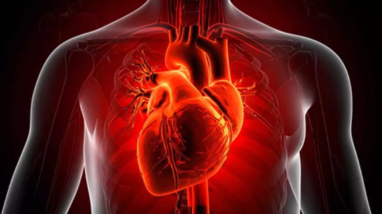 Study shows bacterial infections trigger heart attacks