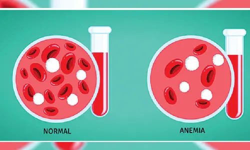 State ranks first in anaemia prevention