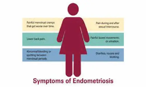 Severe period pain could signal endometriosis, say experts