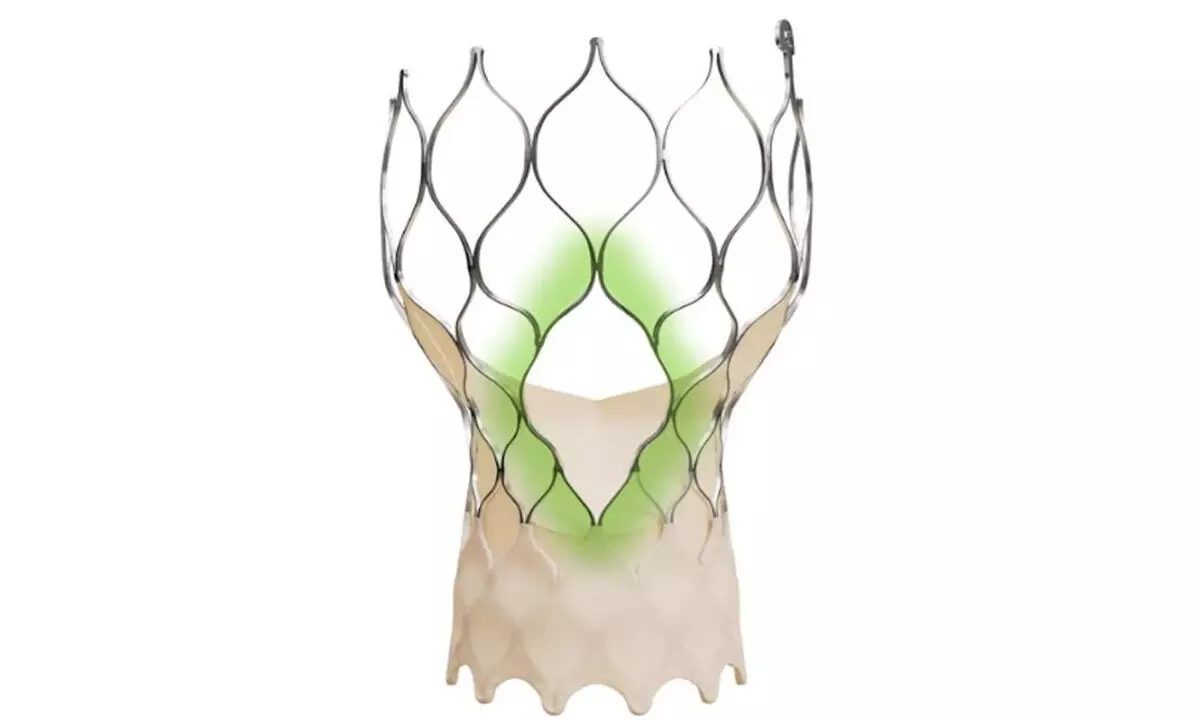 Medtronic Introduces Evolut™ FX+ in India — A Move Forward in TAVI Therapy for Aortic Stenosis Medtronic Introduces Evolut™ FX+ in India — A Move Forward in TAVI Therapy for Aortic Stenosis