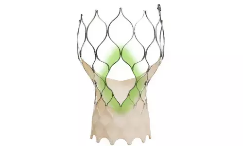 Medtronic Introduces Evolut™ FX+ in India — A Move Forward in TAVI Therapy for Aortic Stenosis