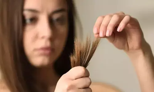 Natural Hair Care Hacks To Stop Split Ends And Boost Stronger Strands