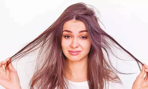 Natural home remedies to relieve dry scalp and restore moisture