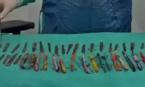 29 spoons, 19 toothbrushes removed from drug addicts stomach