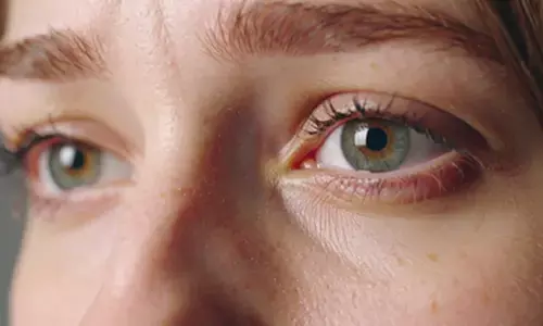 Nearly 1 bn people in low-and middle-income countries living with avoidable vision loss: Report