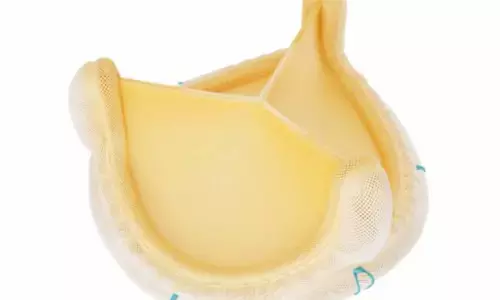 Medtronic launches Avalus Ultra surgical valves in India, enhancing cardiac care for patients