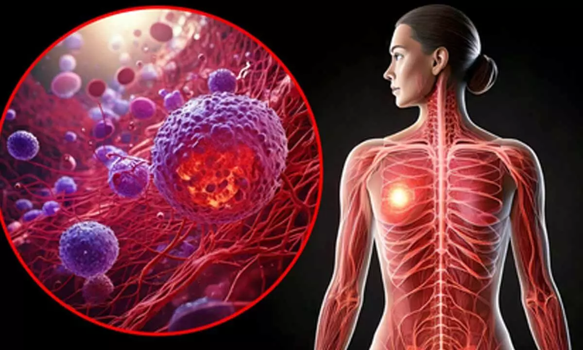 Study warns high-fat keto diet may drive breast cancer risk